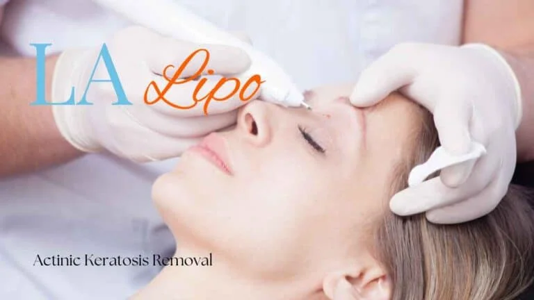 Woman receiving Actinic Keratosis Removal Treatment Swansea