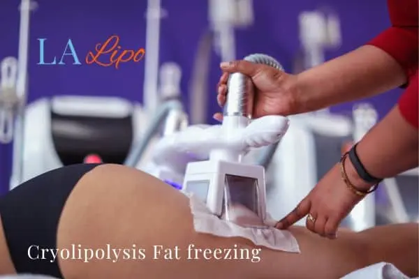 women getting fat freezing Swansea