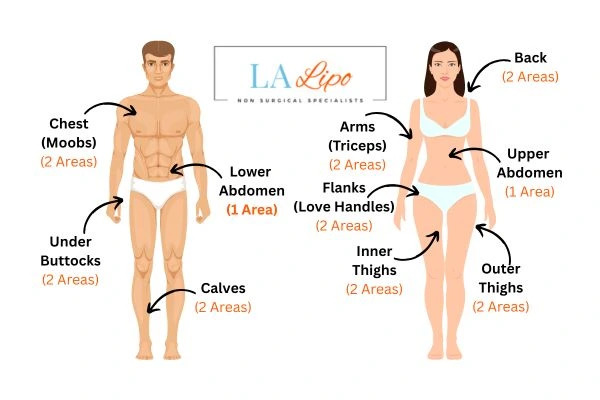 LA LIPO Cryolipolysis Areas Swansea