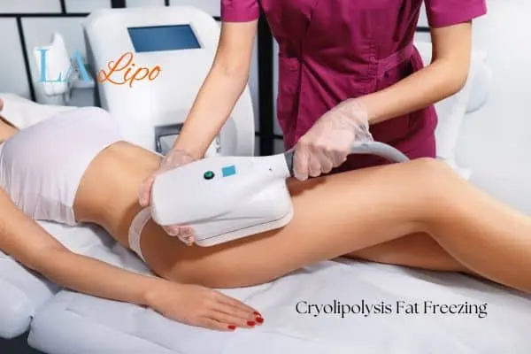 Woman receiving coolsculpting Swansea treatment on her thighs