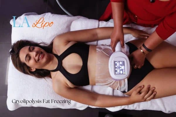 woman getting cryolipolysis Swansea