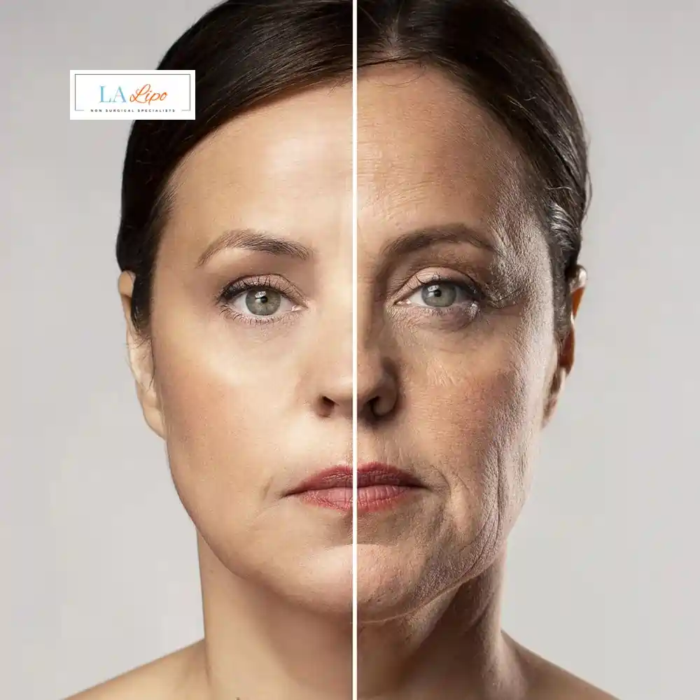 How Can You Tell If Non-Surgical Skin Tightening Is Right for You Swansea?