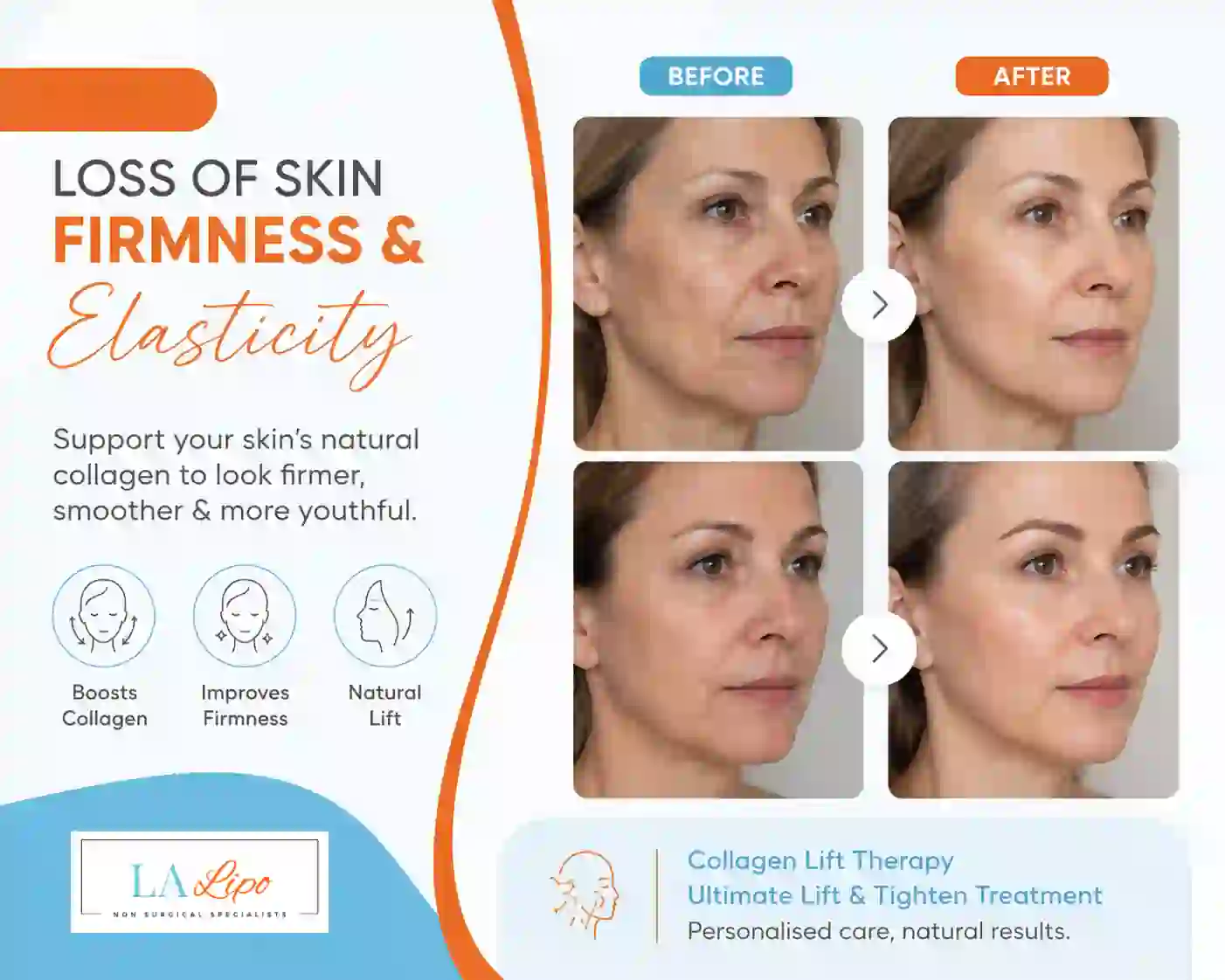 Sign #7: Loss of Skin Firmness and Elasticity Swansea